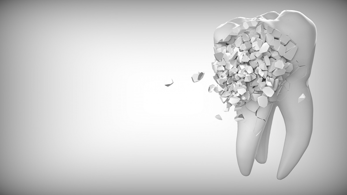 tooth-2874551_1920.jpg tooth-2874551_1920.jpg