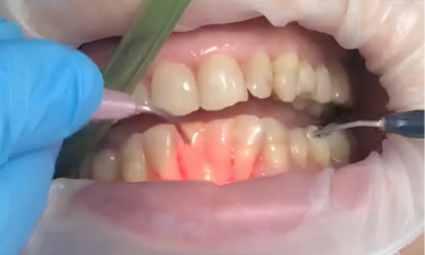 Triplo-2.jpg
